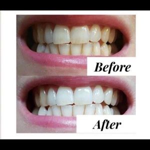 Teeth whitening tooth paste